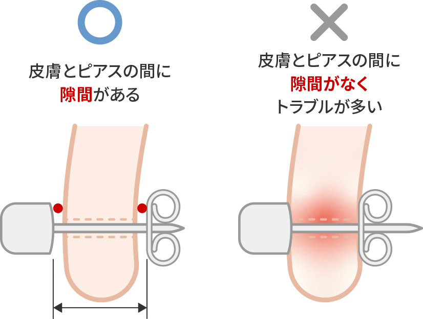 キャッチ（留め具部分）の締め過ぎに注意