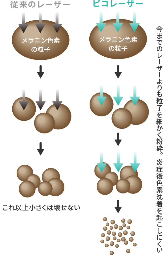 ピコレーザーは従来のレーザーよりもメラニン色素を細かく粉砕します